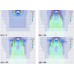 پروژه حل تحلیلی جریان سکون و شبیه سازی عددی پاشش ذرات رنگ تحت شکل دهی هوا و چرخش افشانک با استفاده از نرم افزارهای FLUENT و MAPLE و به همراه فیلم آموزشی نرم افزارهای FLUENT و MAPLE