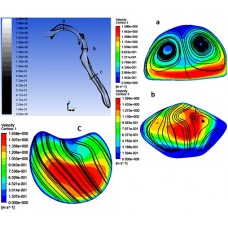 پروژه شبیه سازی عددی جریان هوا و نشست ذرات مایکرو در هندسه‌ واقعی مجرای تنفسی بالایی انسان همراه با نگه داشتن نفس با استفاده از نرم افزار FLUENT